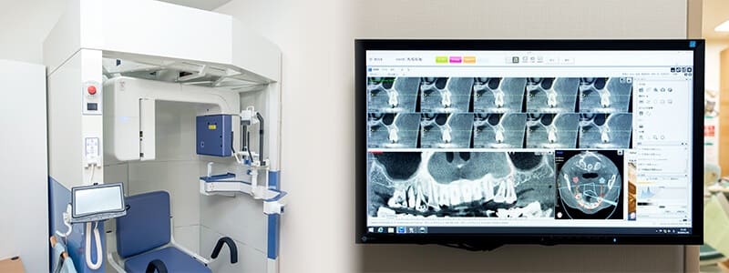 歯科用CT撮影装置